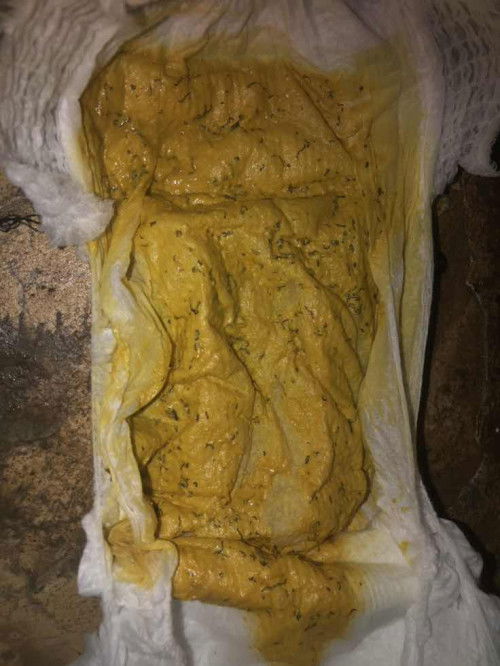 สอบถามแม่ๆหน่อยค่ะ