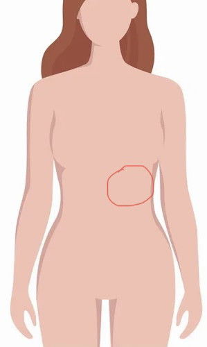 เจ็บแสบบริเวณซี่โครงด้านซ้าย