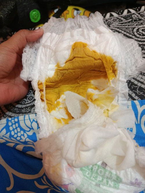 Feses bayi 2 bulan 16 hari