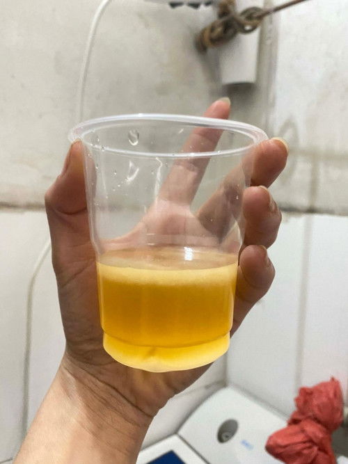 Guys naniniwala ba kayo sa "ihi at asin"  totoo kaya to? If pwede pp, Negative po ba or Positive?