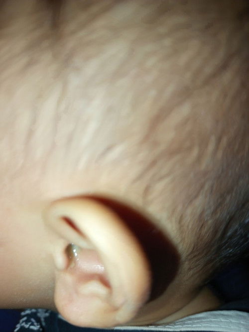 bayi 11 bulan 27 hari