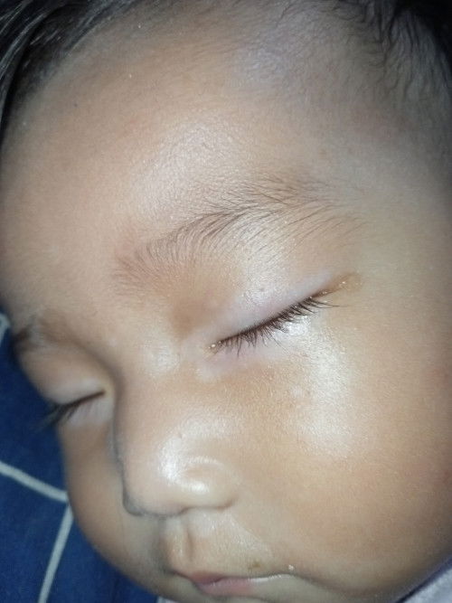 Bund mau nanya ini kira2 penyakit apa ya ?