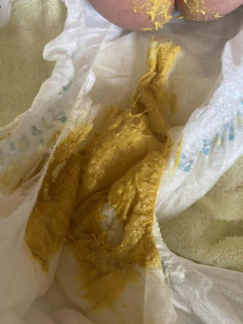 นมผง+นมแม่ เสริม