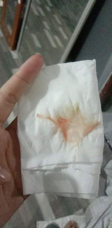 สอบถามแม่ๆหน่อยค่ะ