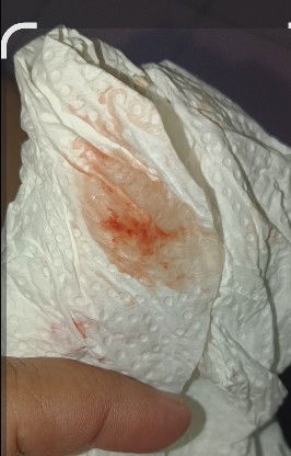 Ingin pasti spotting atau haid