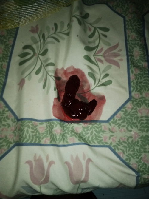 Keluar gumpalan darah