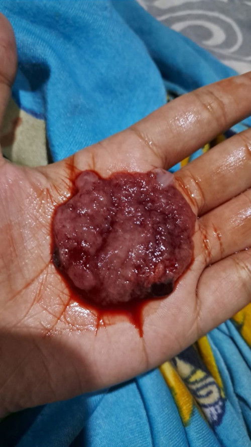 Bun mau tnya apa ini keguguran