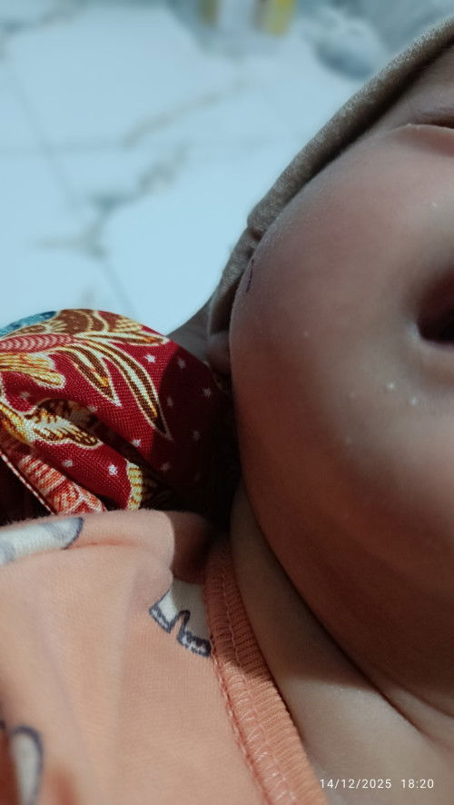 Bintik putih diwajah