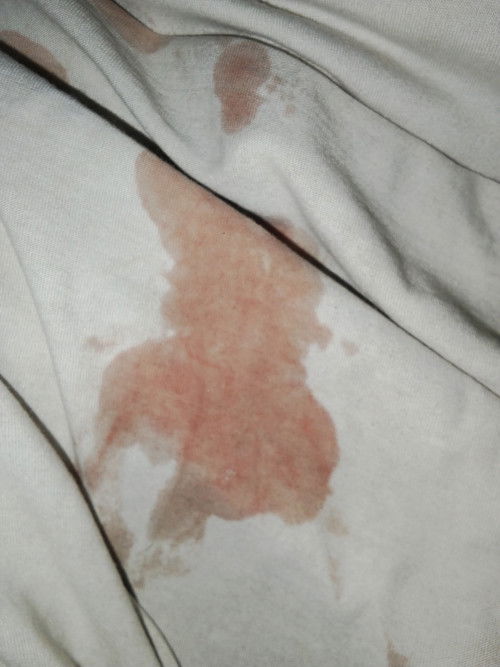 Hamil 23 Minggu setelah Hb sama suami ko keluar flek kaya gitu tapi ga disertai nyeri apapun