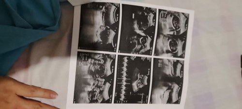 Ultrasound Ngayon lang po it's okay lang po ba