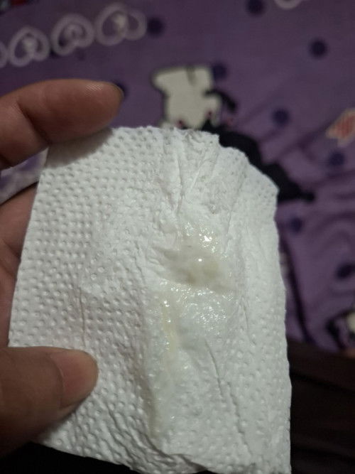 39w2d มูกใส