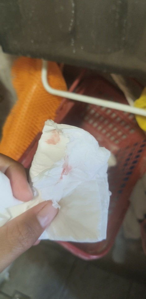 มีเลือดออก