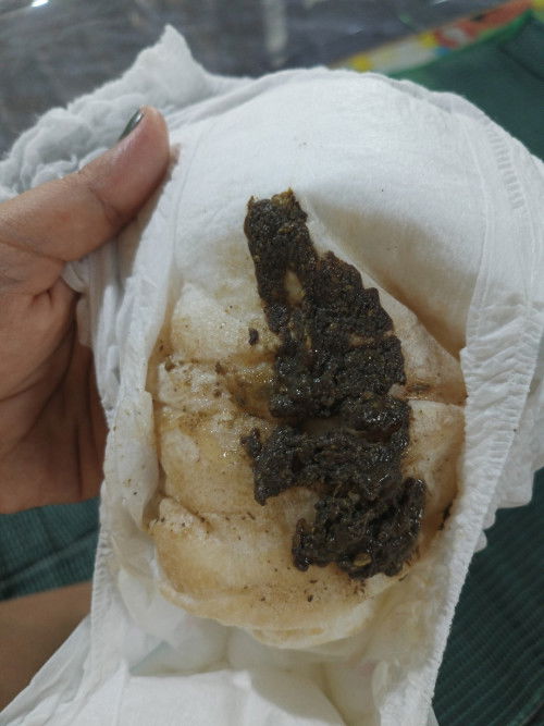 รูปถ่ายเป็นสีเทาเข้ม