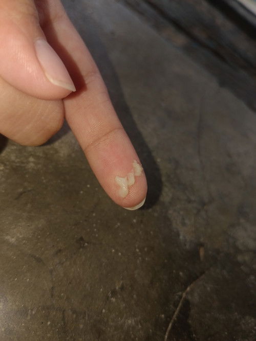 Normal lg poba na may lumalabas na ganto saken btw 17weeks first time mom po ako