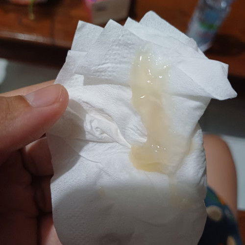 HAMIL 35 WEEK KEPUTIHAN