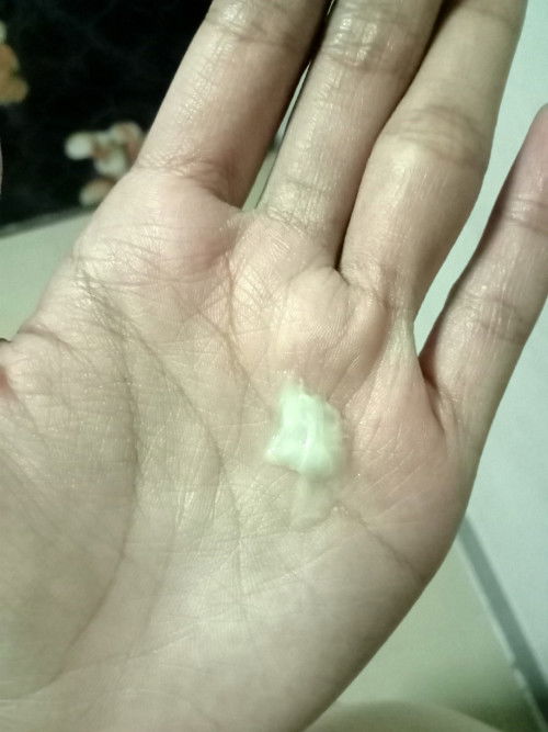 ใช่มูกใสหรือไม่