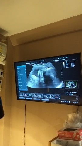 น้ำหนักลูกน้อยไปมั้ย