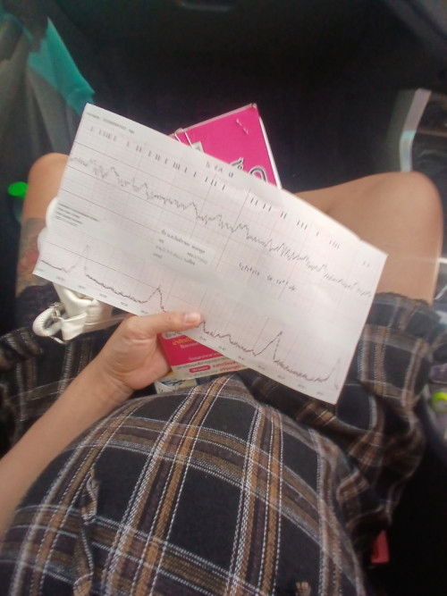 37+3วีค หมอนัดติดเครื่องNSTประมาณ30นาทีแล้วท้องปั้น5-6นาทีต่อครั้ง แต่ไม่มีอาการใดๆ