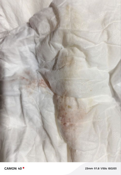 38 weeks  EDD: December 26