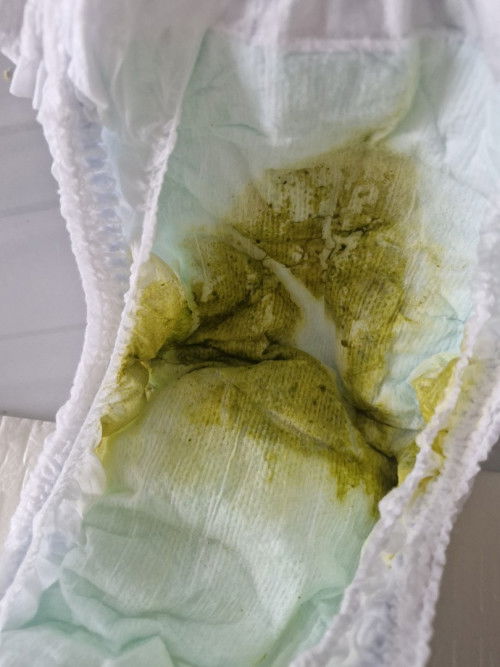 Bayi 7 bulan pup berwarna hijau dan cair