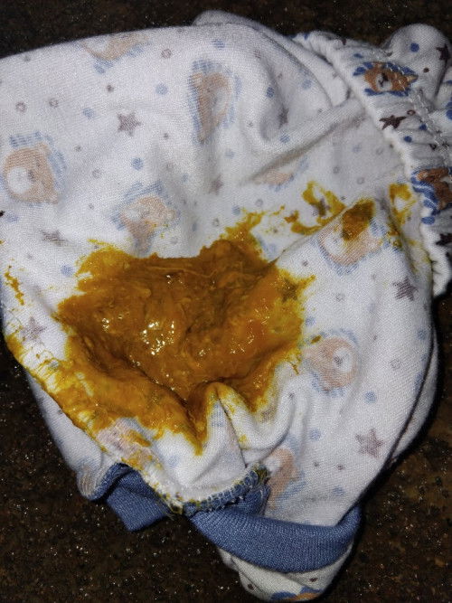 Pup bayi kuning lembek masih ada lendir nya. Berbagi pengalaman ya bund