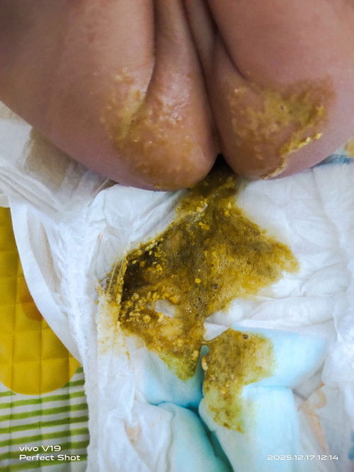 Najis baby 4bulan22hari