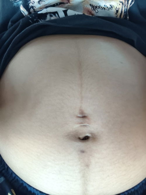 เเบบนี้สะดือคว่ำหรือหงายคะ