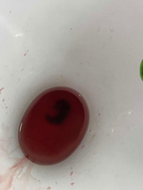 แท้งทุกคาม มีก้อนหลุดออกมาแท้งมั้ยคะ