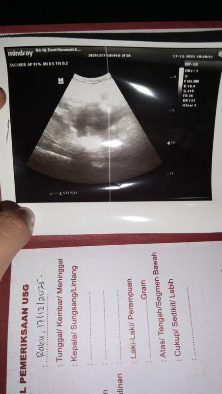 4minggu usg tapi belum ada kantong nya baru penebalan dinding rahim itu gapapa ya?