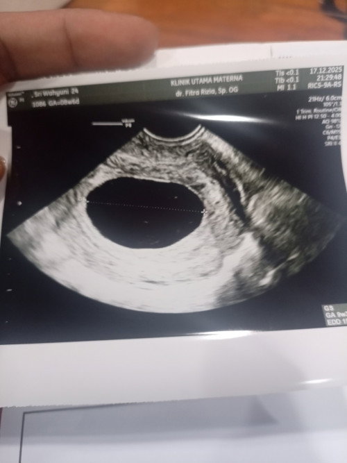 9 Week (HPHT Juli 2026)