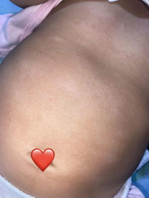 น้อง4เดือนกว่า