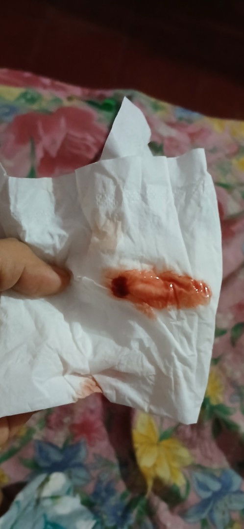 Maaf bun sedikit jorok ya 38week 6d keluar darah