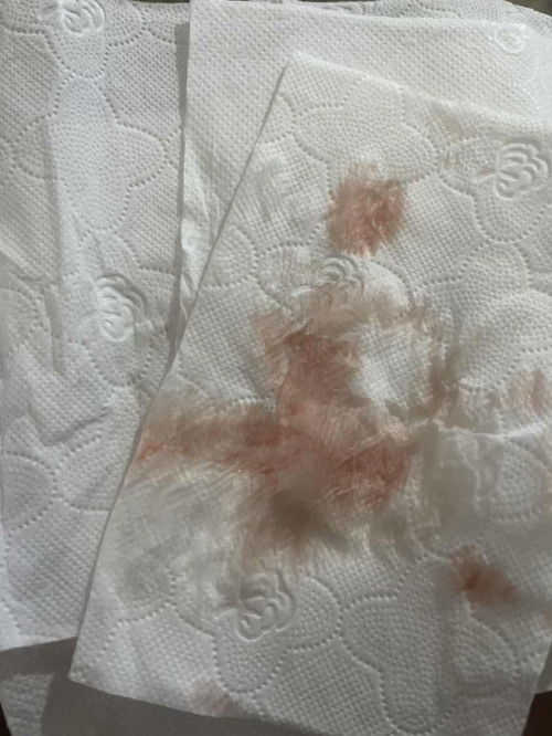 39+4 มีอาการปวดหน่วงท้องร่วมด้วย ขออภัยสำหรับรูปภาพด้วยค่ะ