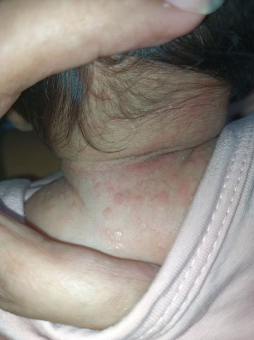 NEED ADVICE / SUGGESTION