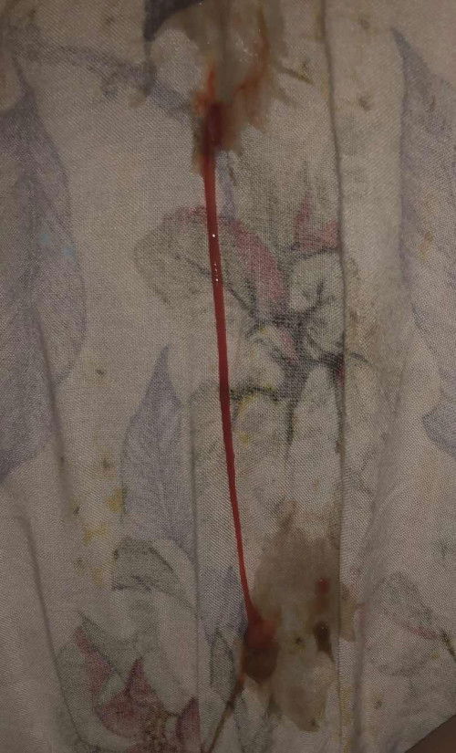 Kluar lendir darah gini apakah pertanda bun?