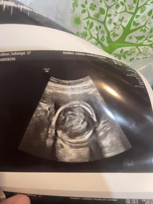 5เดือนแล้วอยากให้นมลงลูกกินนมอะไรดีค่ะ