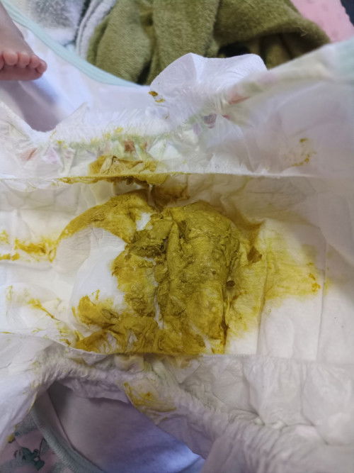 1เดือน15วัน ถ่ายแบบนี้ปกติไหมค่ะ