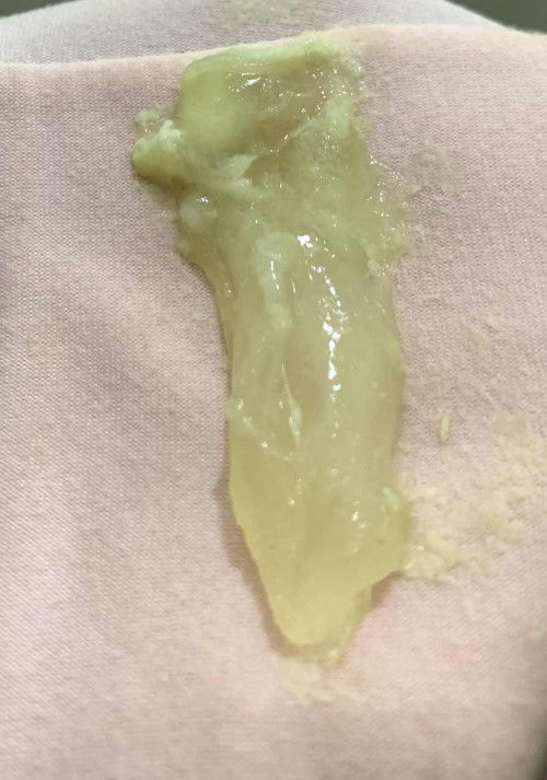 HPL desember UK 39w4d