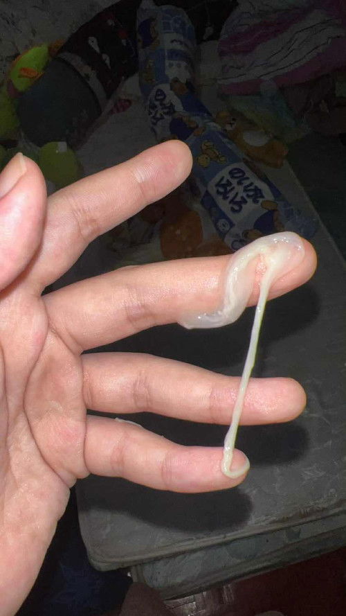 มูกหรือตกขาว