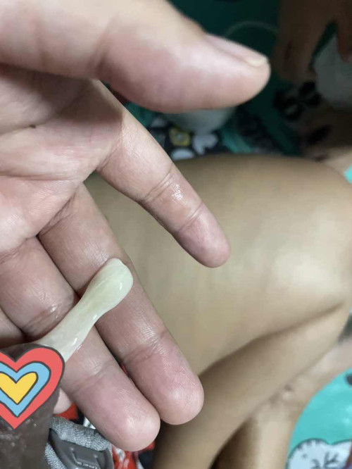 ปั๊มนมเเล้วมีลิ่มออกมาเเบบนี้ทุกรอบเลยค่ะ