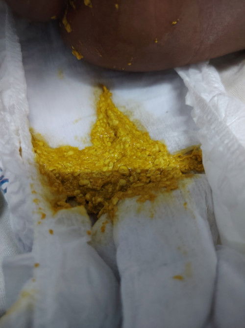 NORMAL KA TAHI BABY NEWBORN