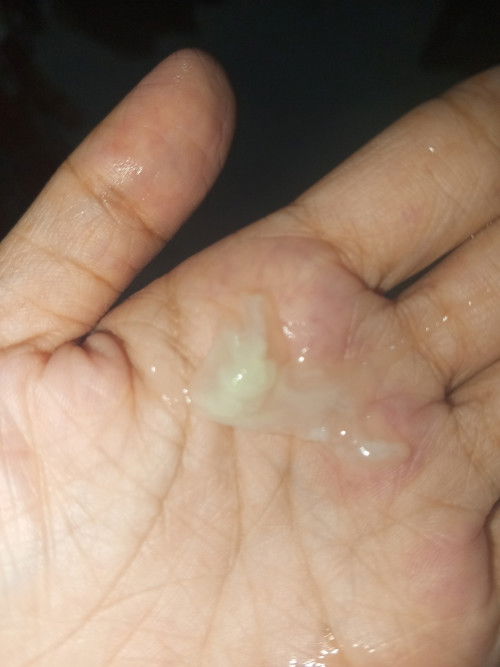 pasintabi po 6months preggy! no pain walang amoy pero pag kaihi ko may ganyan ako nahawakan white si