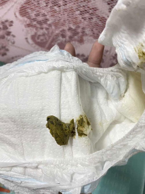 7เดือน15วันอึแบบนี้ปกติไหมคะ