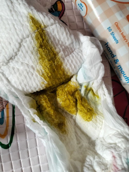 Masalah pup pada bayi 5 bulan 24 hari