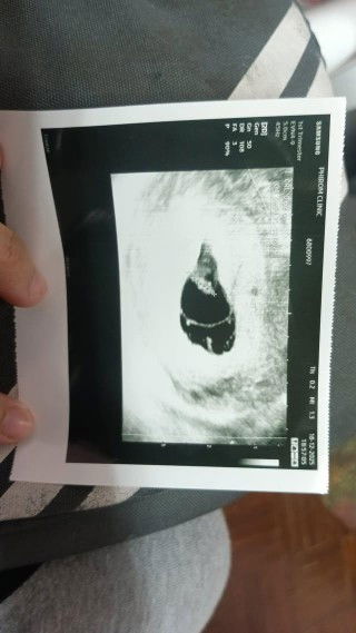 9 weeks หมอรพและคลีนิค บอกว่าน้องไม่โต