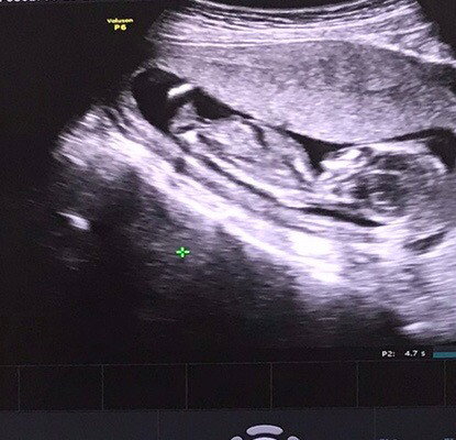 แบบนี้ปกติไหมคะ