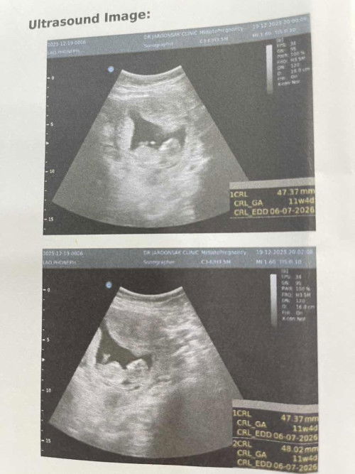 แม่ๆบ้านไหนทีมกรกฎา69 บ้างคะ