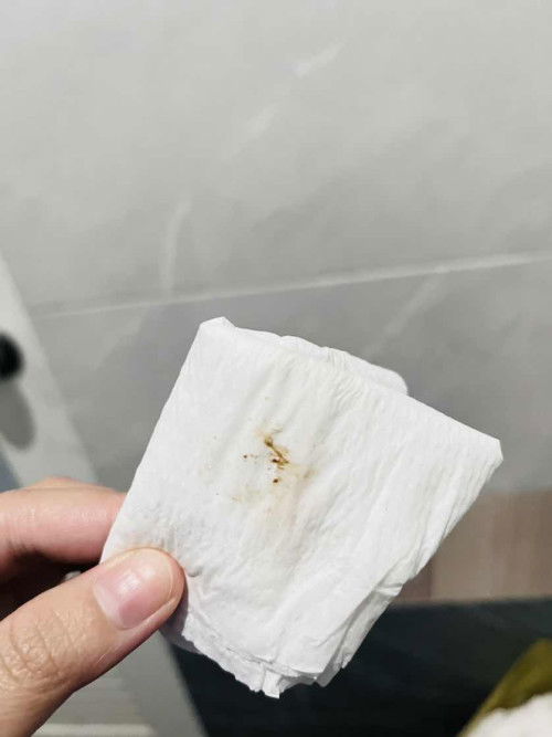 สอบถามแม่ๆหน่อยค่ะแบบนี้คืออะไรคะ