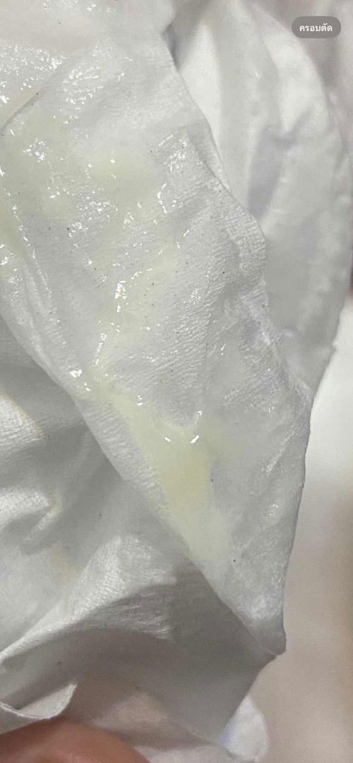 อันนี้คือมูกหรือตกขาวค่ะท้องแรกไม่รู้อะไรไหลออกมา