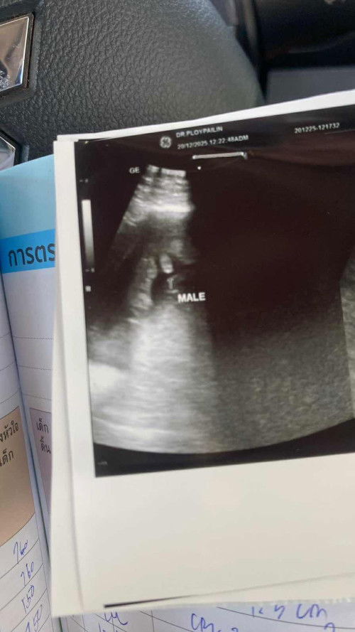 น้องโชว์แบบนี้มีโอกาสเป็นหญิงไหมคะ